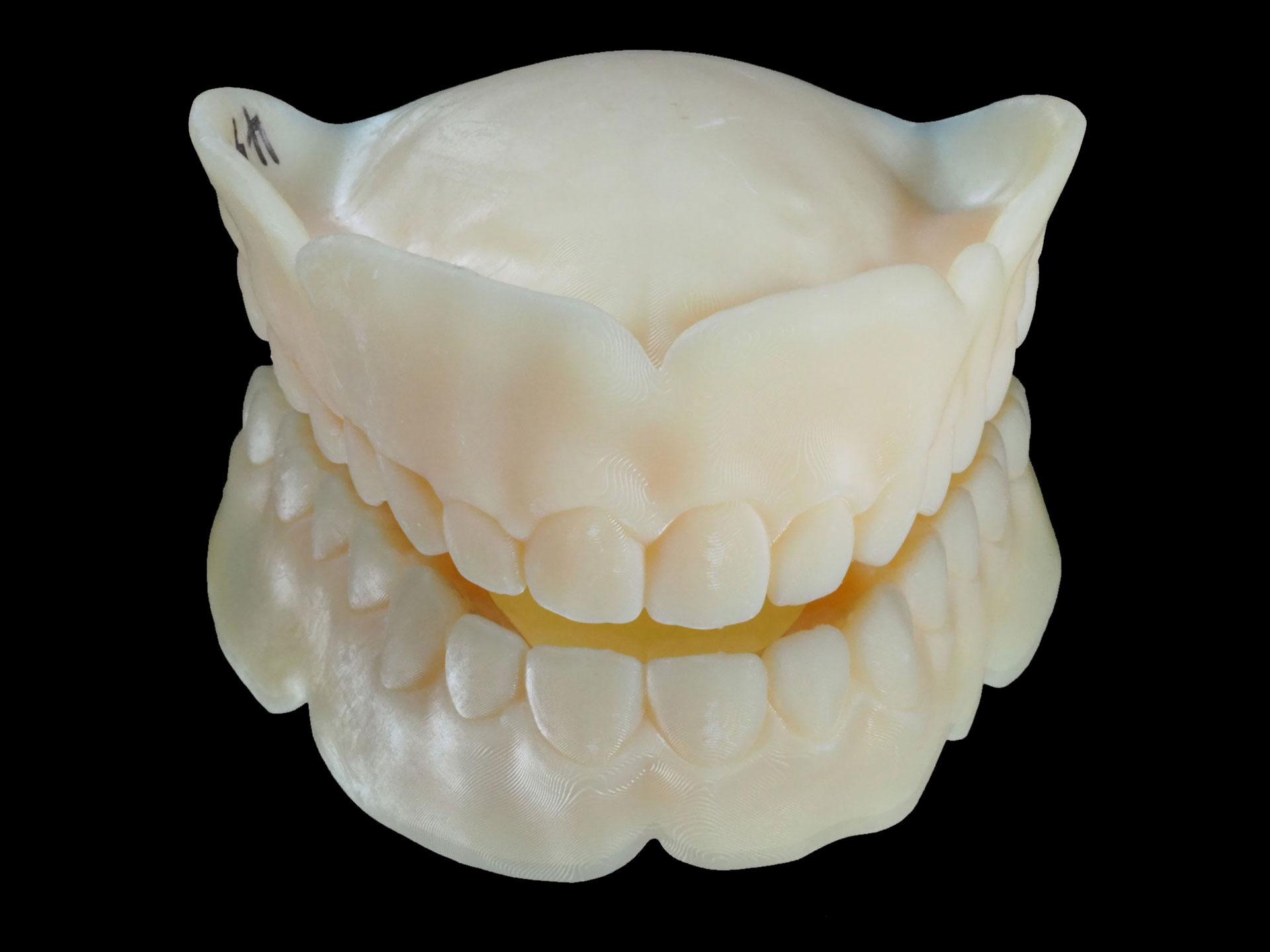 aa temp /3d 列印临时假牙树脂